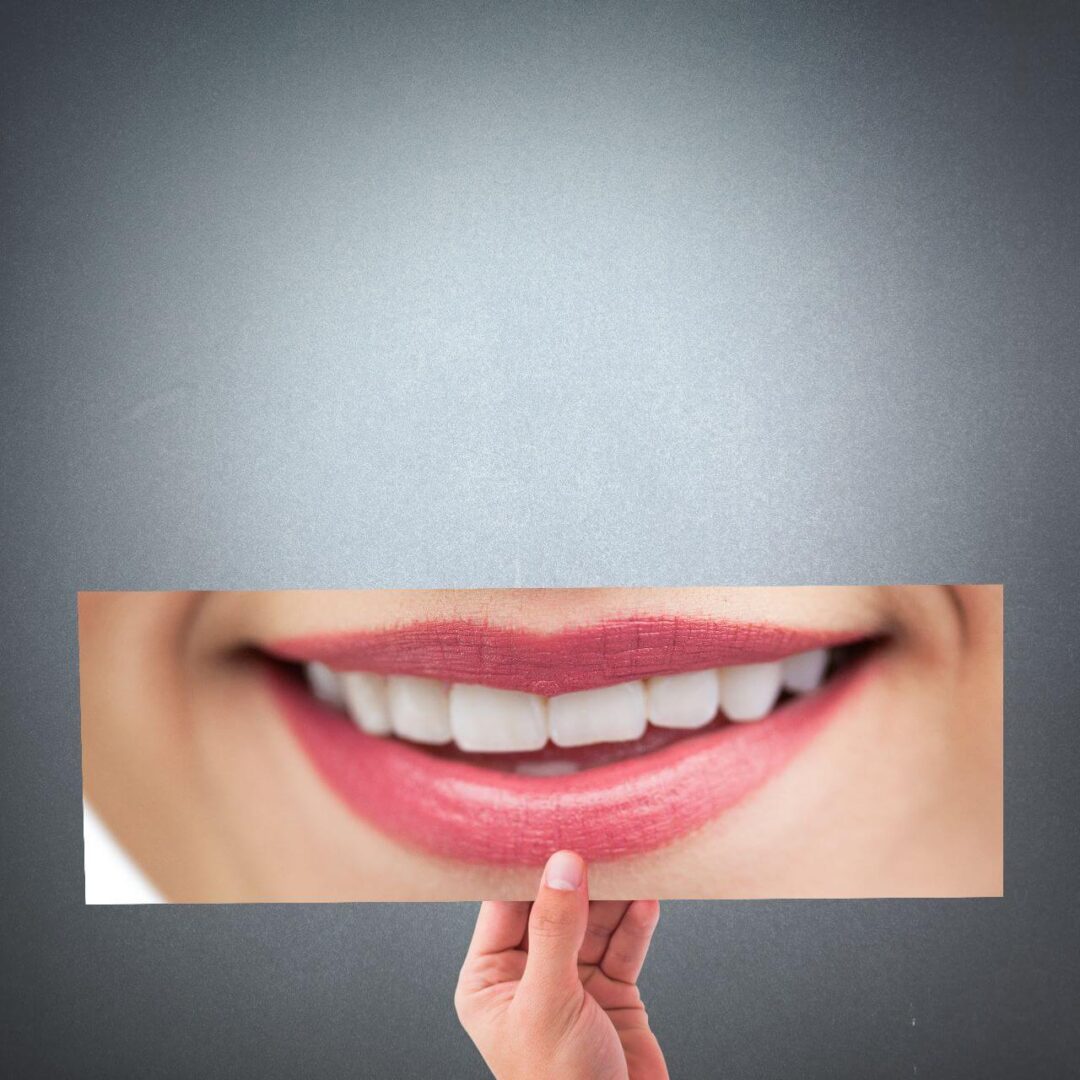 ابتسامة هوليوود او ابتسامة النجوم او هوليود اسمايل في مصر مركز عمارة للأسنان The Hollywood smile in Egypt Omara Dental Centers