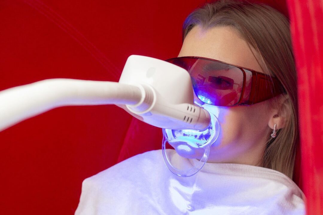 تبييض الاسنان بالليزر في مركز عمارة للأسنان Laser teeth whitening On Omara Dental Centers