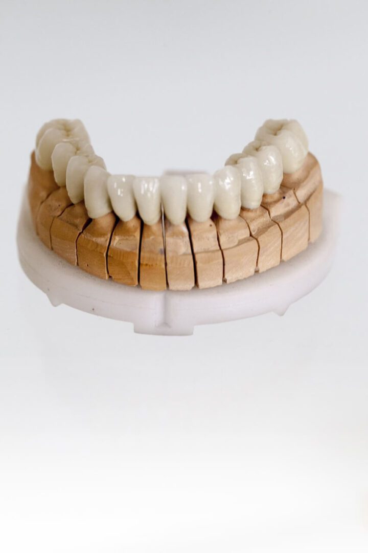 تركيبات الأسنان الثابتة fixed prosthesis