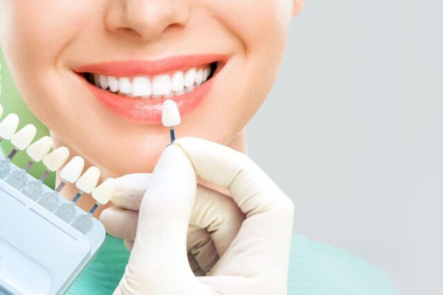 تركيبات الأسنان الثابتة , Fixed Dental Prosthetics , fixed prosthesis , مركز الدكتور محمد عمارة , Omara Dental Centers , Omara Centri Odontoiatrici , protesi dentali fisse , prothèses dentaires fixes , Omara Centres dentaires