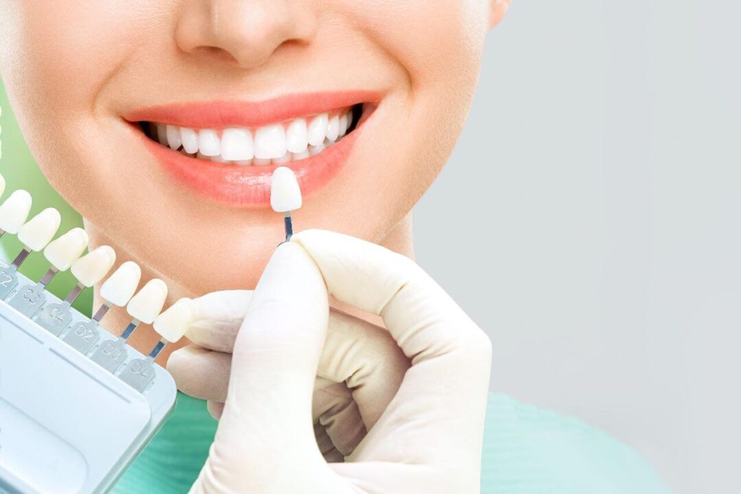 تركيبات الأسنان الثابتة , Fixed Dental Prosthetics , fixed prosthesis , مركز الدكتور محمد عمارة , Omara Dental Centers , Omara Centri Odontoiatrici , protesi dentali fisse , prothèses dentaires fixes , Omara Centres dentaires
