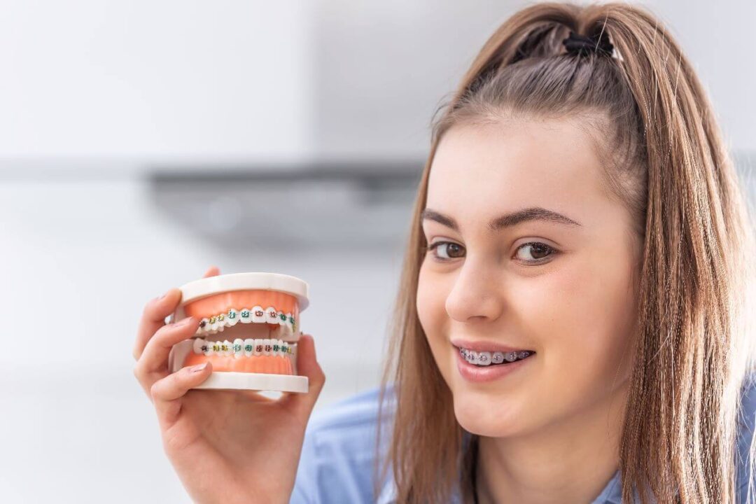 تقويم الأسنان مركز الدكتور محمد عمارة لطب الاسنانWhat is orthodontics Omara Dental Center