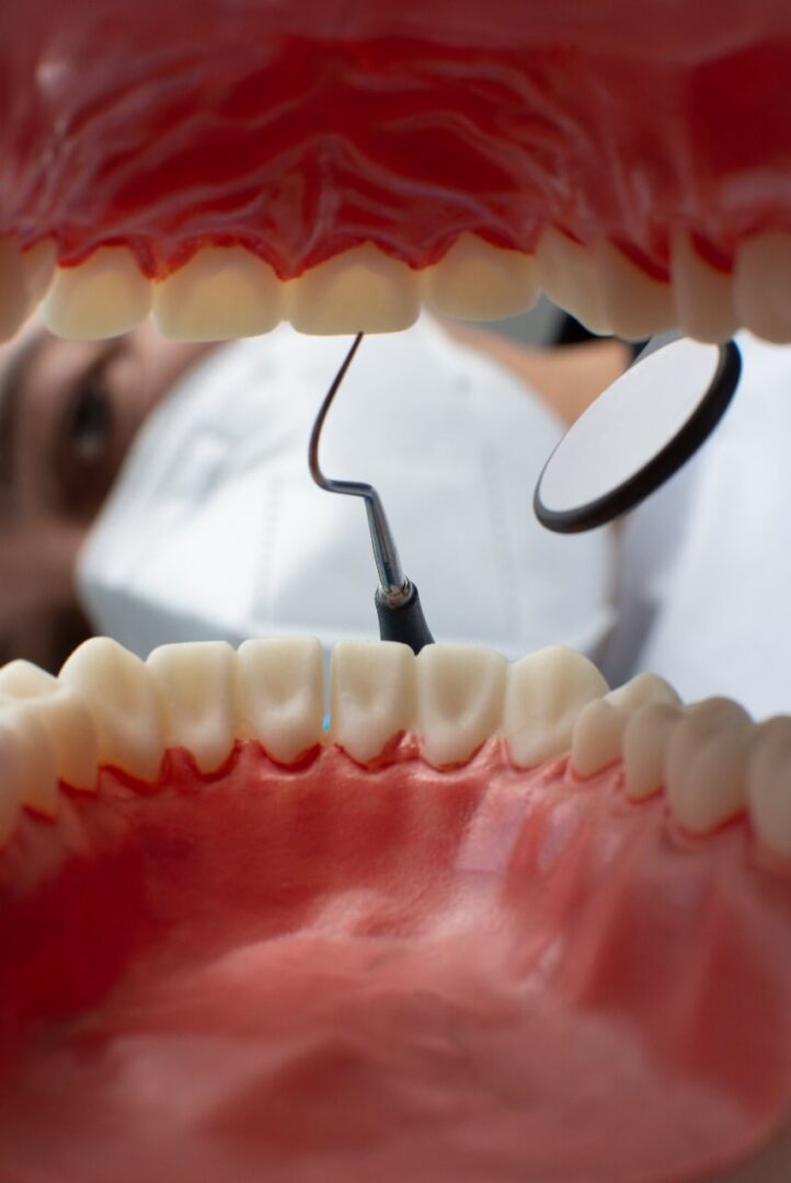 خلع الأسنان مركز الدكتور عمارة لطب الاسنان Tooth extraction Omara Dental Centers