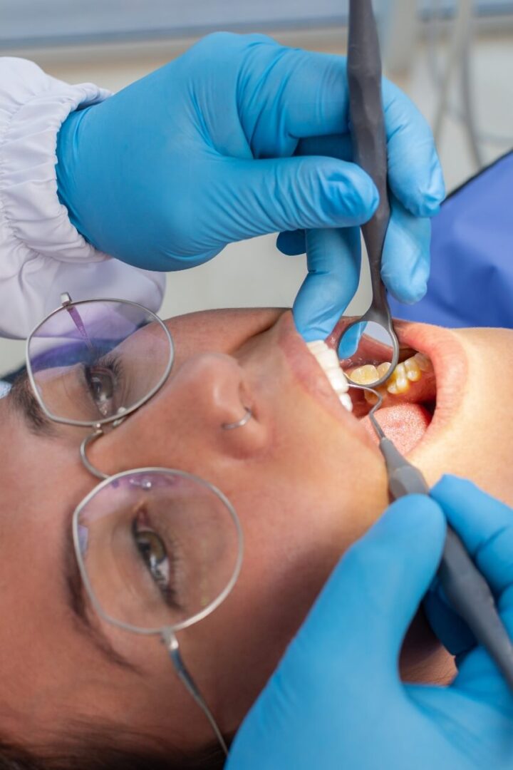 خلع الأسنان مركز الدكتور عمارة لطب الاسنان Tooth extraction Omara Dental Centers