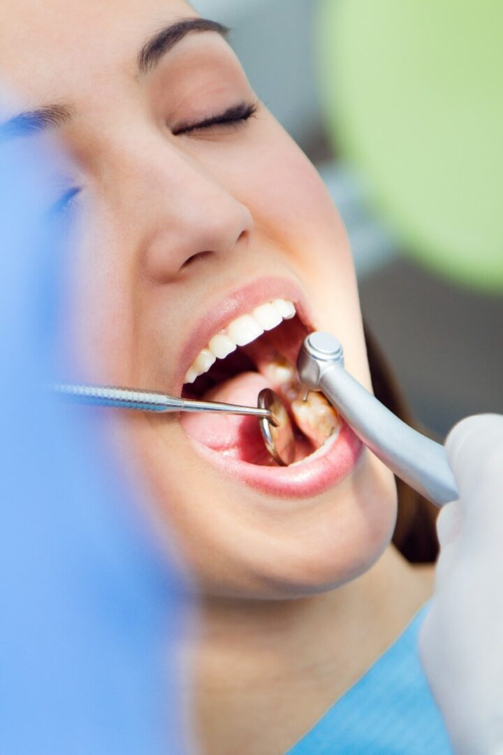 خلع ام حشوات الاسنان مركز الدكتور عمارة لطب الاسنان Tooth Extraction or Fillings Omara Dental Centers