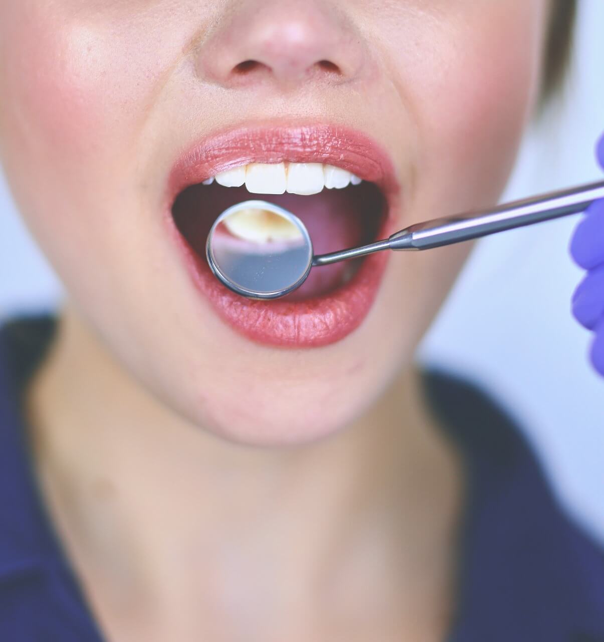 علاج أمراض اللثة للأسنان مركز الدكتور محمد عمارة لطب الاسنان Periodontitis (Gum Disease) Periodontal Disease Omara Dental Centers