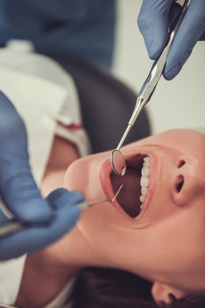 علاج أمراض اللثة للأسنان مركز الدكتور محمد عمارة لطب الاسنان Periodontitis (Gum Disease) Periodontal Disease Omara Dental Centers