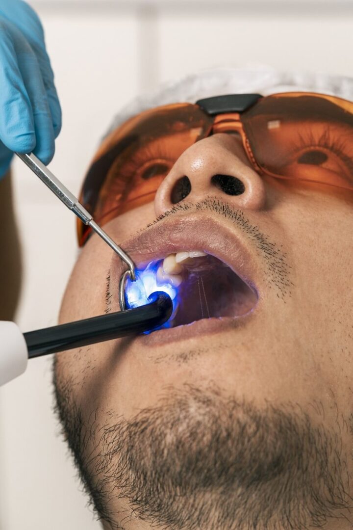 علاج جذور الأسنان مركز الدكتور محمد عمارة لطب الاسنان root canal treatment Omara dental center 16