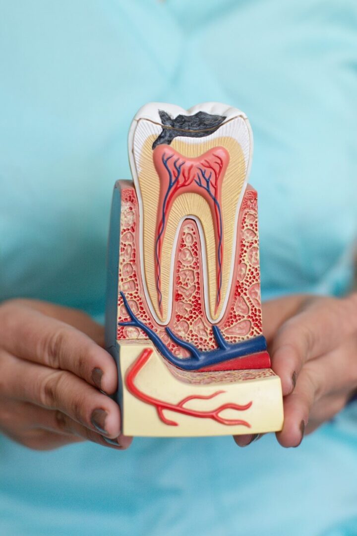 علاج جذور الأسنان مركز الدكتور محمد عمارة لطب الاسنان root canal treatment Omara dental center 2