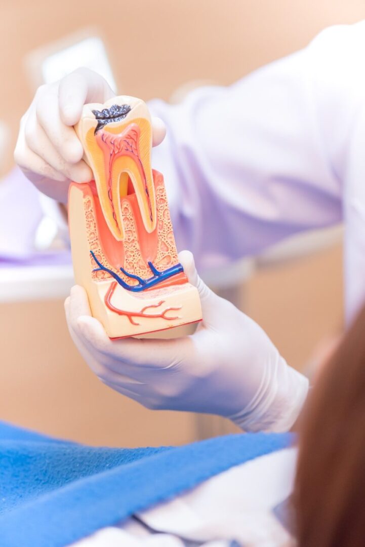 علاج جذور الأسنان مركز الدكتور محمد عمارة لطب الاسنان root canal treatment Omara dental center 6
