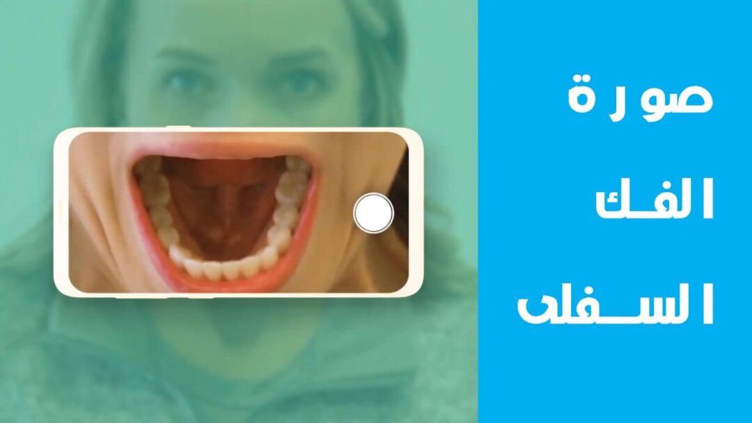 كيف تصور أسنانك مركز عمارة للأسنان Omara Dental Centers. How to take photos of your teeth