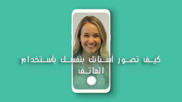 كيف تصور أسنانك مركز عمارة للأسنان Omara Dental Centers. How to take photos of your teeth