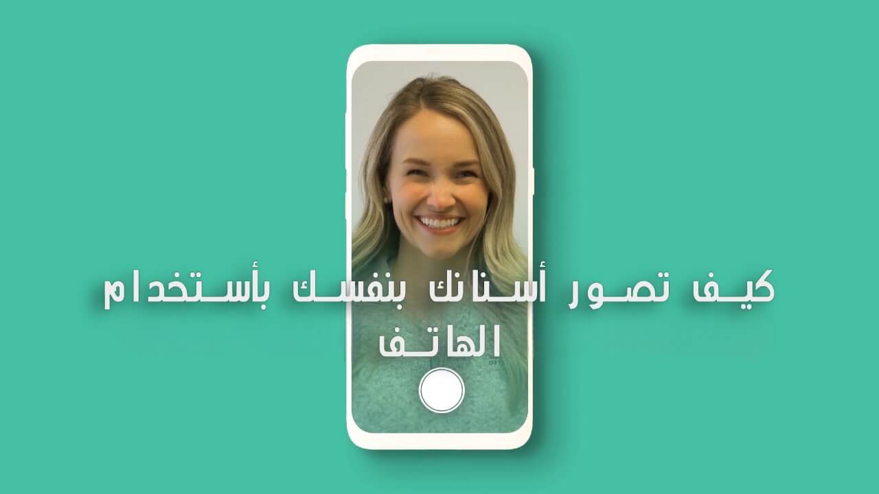 كيف تصور أسنانك مركز عمارة للأسنان Omara Dental Centers. How to take photos of your teeth