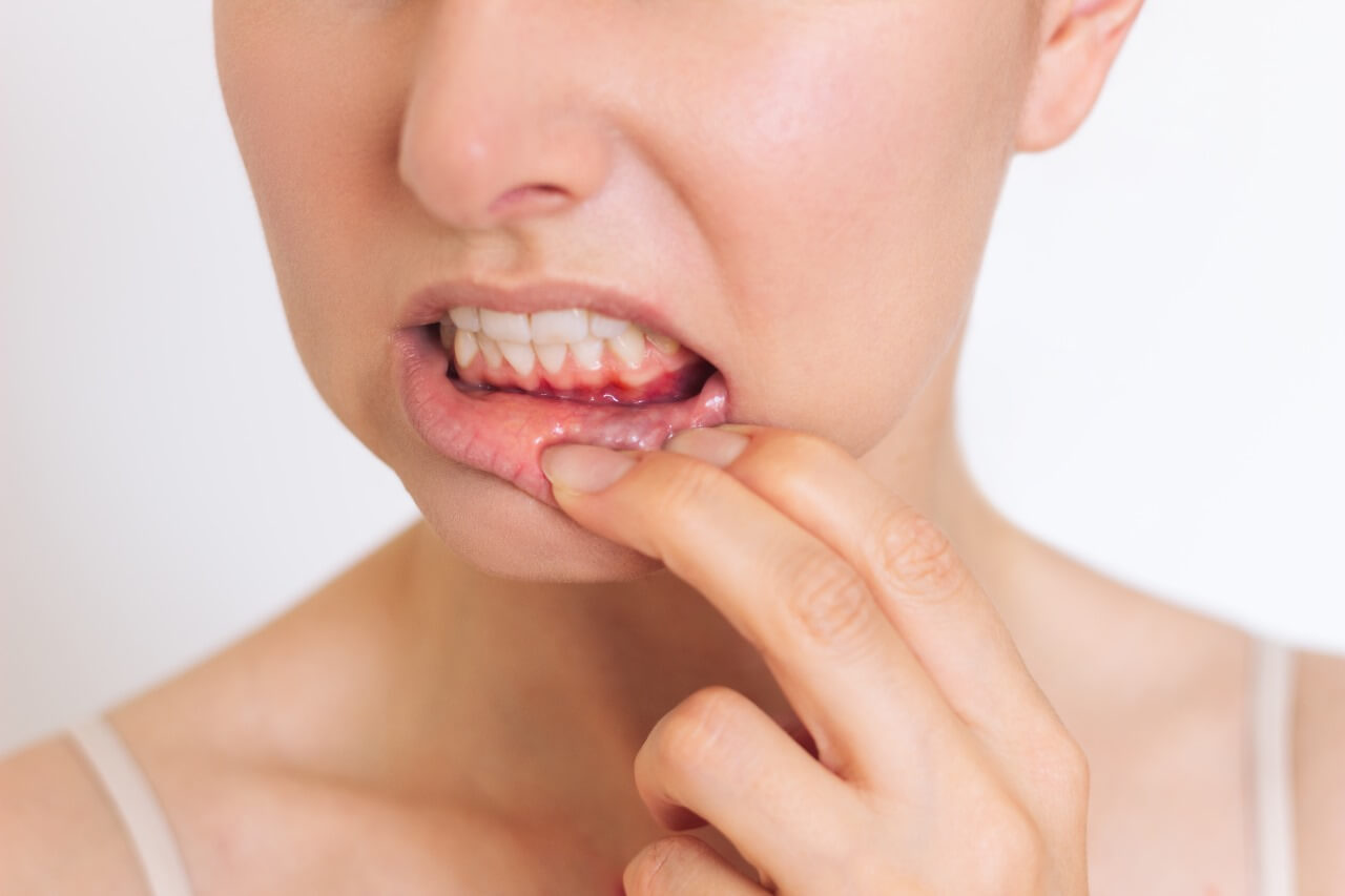 أسباب رائحة الفم الكريهة, مراكز الدكتور محمد عمارة لطب الاسنان , Causes of Bad Breath , Cause di alito cattivo , Omara Dental Centers , Omara centri odontoiatrici