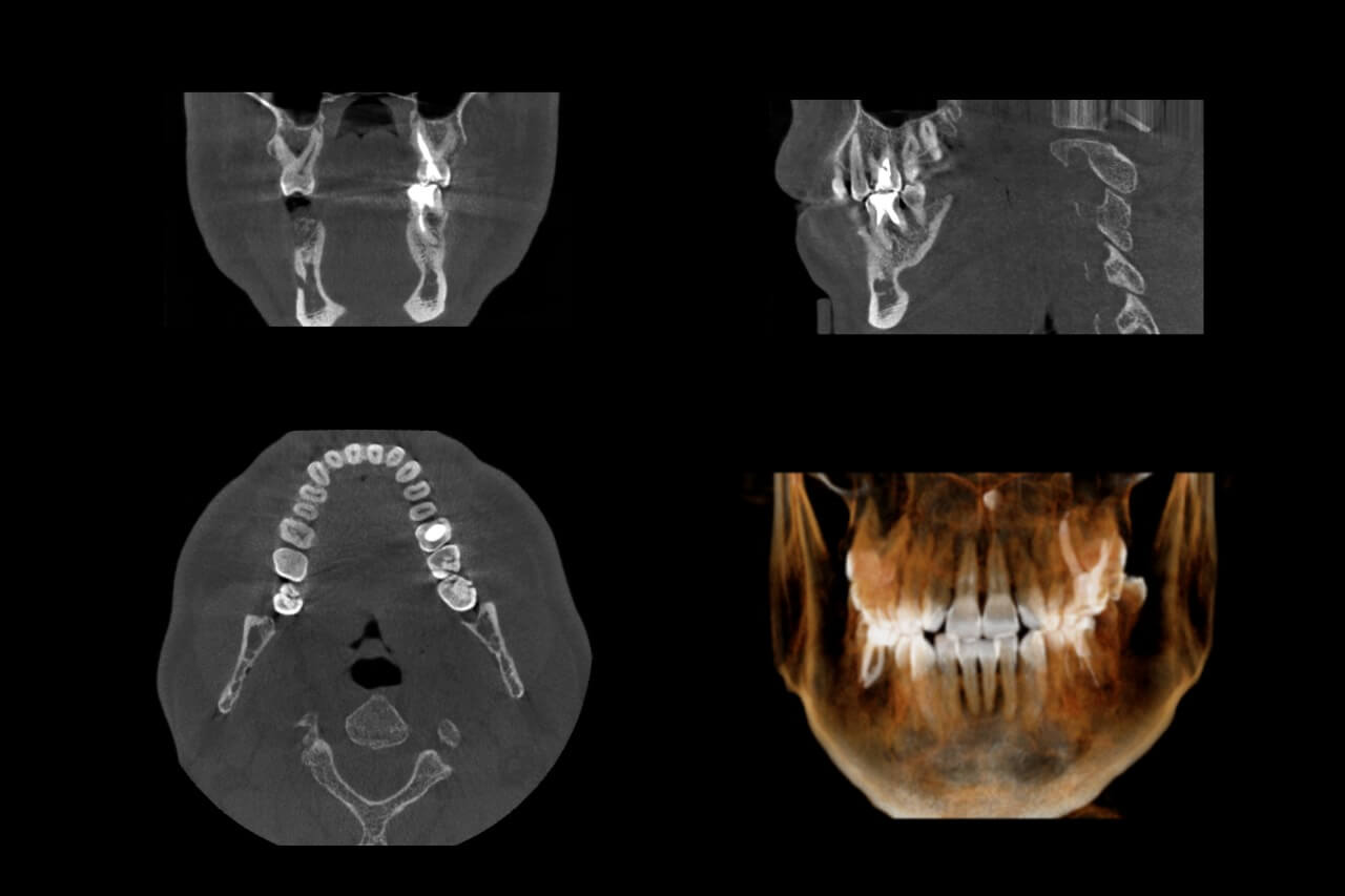 الأشعة البانورامية والأشعة المقطعية مركز عمارة للاسنان Panoramic X-rays and CT scans , Raggi X panoramici e scansioni TC , Radiographie Panoramique et Scanner (CBCT) , Omara Centres Dentaires
