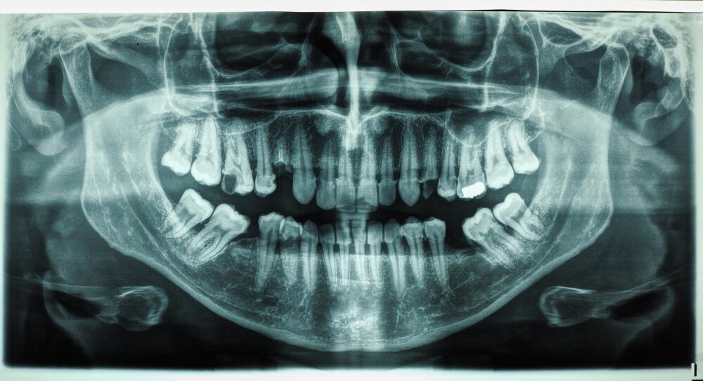 الأشعة البانورامية والأشعة المقطعية مركز عمارة للاسنان Panoramic X-rays and CT scans , Raggi X panoramici e scansioni TC , Radiographie Panoramique et Scanner (CBCT) , Omara Centres Dentaires