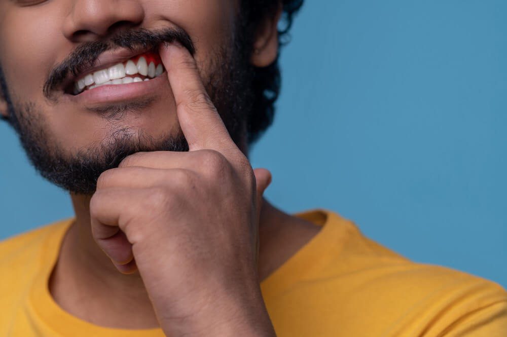 الفرق بين التهابات اللثة وأمراض اللثة علامات وأسباب وعلاج مركز الدكتور محمد عمارة لطب الاسنان The difference between gingivitis and gum disease , La differenza tra gengivite e malattie gengivali