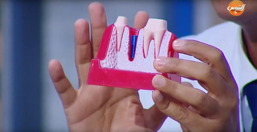 د محمد عمارة Dr. Mohamed Omara1 -