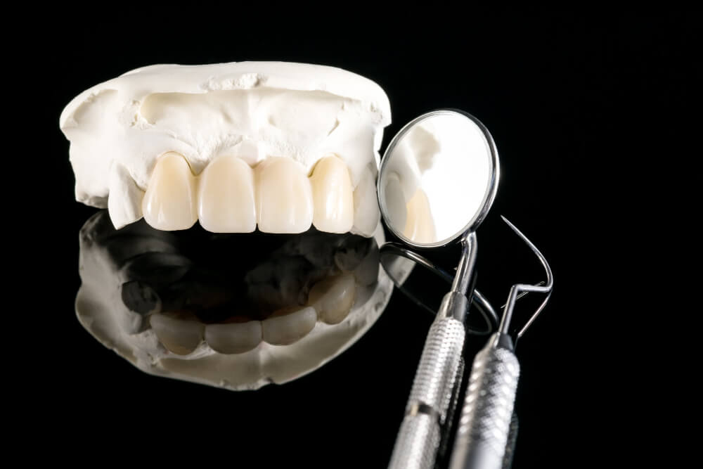 Dental Implants , Impianti dentali in Egitto , زراعة الأسنان ,تجميل اليوم الواحد, تجميل الأسنان الفوري , مراكز الدكتور محمد عمارة لطب الاسنان