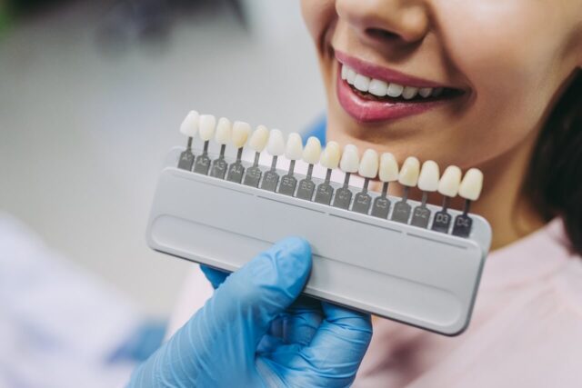 تعليمات بعد تركيب الأسنان - Instructions After Dental Crown and Bridge - Istruzioni Dopo il Posizionamento di Corone e Ponti - Instructions Après la Pose de Couronnes et Bridges