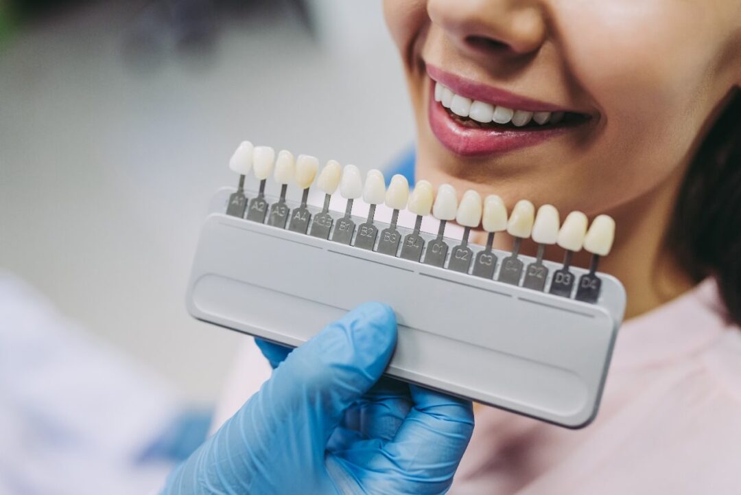 تعليمات بعد تركيب الأسنان - Instructions After Dental Crown and Bridge - Istruzioni Dopo il Posizionamento di Corone e Ponti - Instructions Après la Pose de Couronnes et Bridges